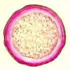 elm pollen image