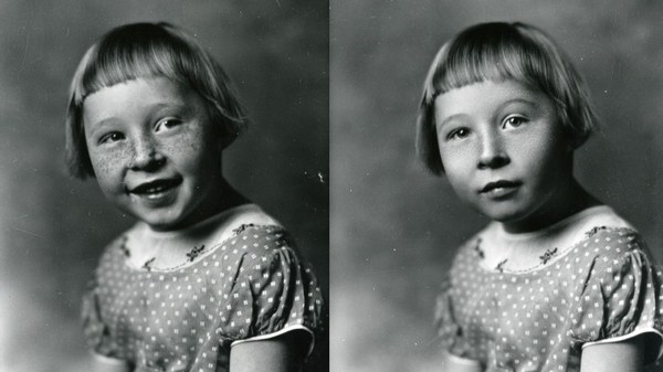 A before and after photo (both vintage black and white images) of a young girl named Mary Ann Arnold.